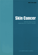 Skin Cancer